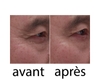 Wrinkle power x3