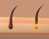 Root active