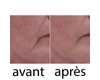 Wrinkle power x3