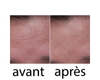 Wrinkle power x3